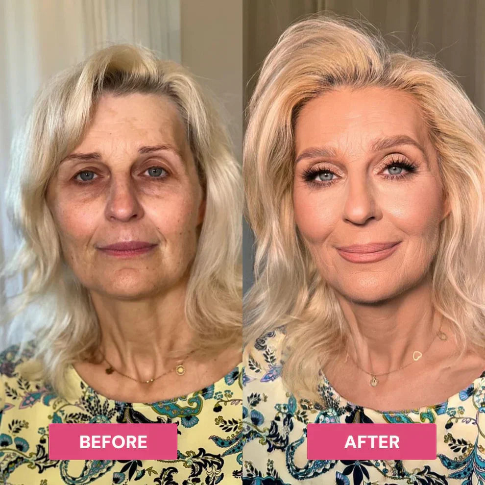 ✨ LAST DAY: BUY 1 GET 1 FREE ✨ Revive Tired Eyes with Our Hydrating & Anti-Wrinkle Eye Balm