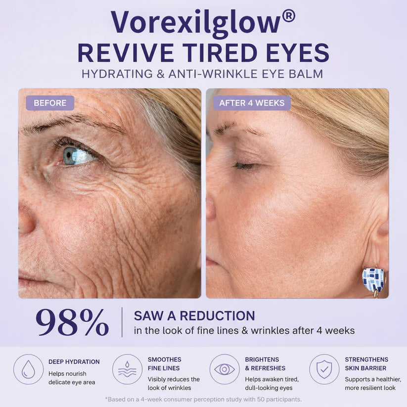 ✨ LAST DAY: BUY 1 GET 1 FREE ✨ Revive Tired Eyes with Our Hydrating & Anti-Wrinkle Eye Balm