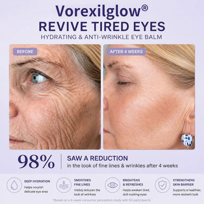 ✨ LAST DAY: BUY 1 GET 1 FREE ✨ Revive Tired Eyes with Our Hydrating & Anti-Wrinkle Eye Balm